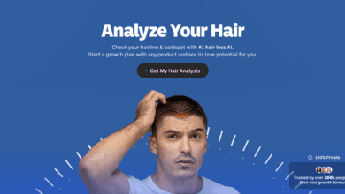 Myhair.AI: نموذج مخصص لتشخيص الصلع الوراثي 6 Screenshot at Nov 28 15 31 44