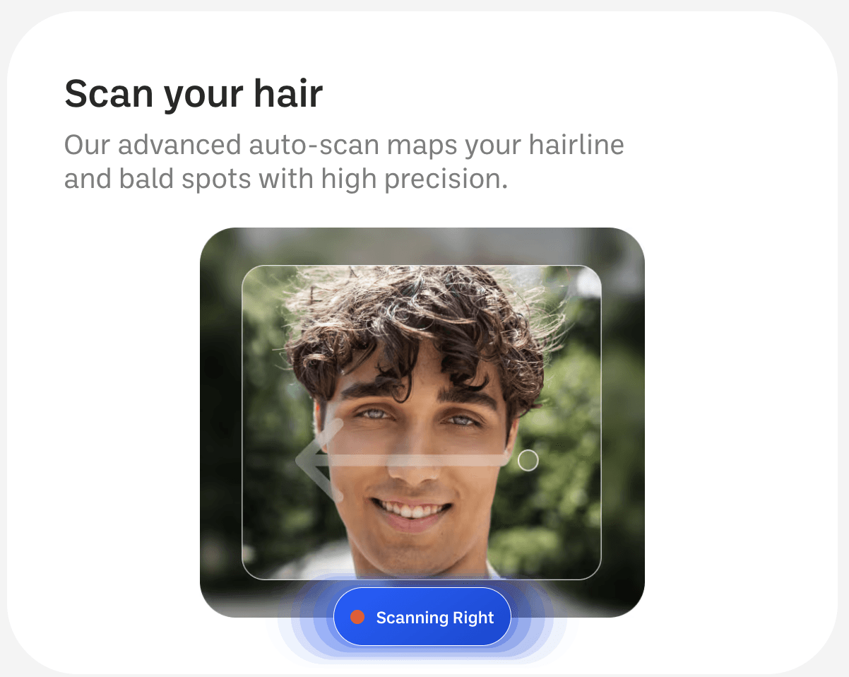 Myhair.AI: نموذج مخصص لتشخيص الصلع الوراثي 2 Screenshot at Nov 28 15 32 12